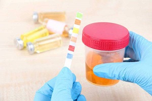 رنگ ادرارچه رازهایی از سلامتی شمارا برملا می کند