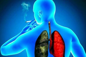 ۵ روش طبیعی برای سم زدایی از ریه افراد سیگاری (مطلب)