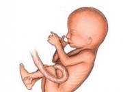علت های لگد زدن جنین چیست ؟ (مطلب)