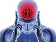 نشانه و علائم سکته مغزی چیست؟ (مطلب)