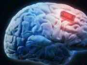کاشت تراشه‌های ARM درون مغز (مطلب)
