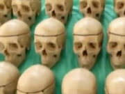 ویدئو :   ساخت استخوان از وسایل بازیافتی (مطلب)