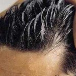 دلایل چرب شدن موی سر و راههای کاهش آن (مطلب)