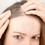 درمان خانگی سفید شدن مو که واقعا موثر هستند (مطلب)