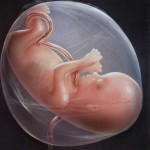 ناهنجاری‌های جنین را چگونه تشخیص دهیم (مطلب)