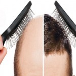 ۴۰ دلیل شایع ریزش مو + راهکار‌های درمانی (مطلب)