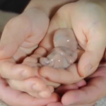 ویدئو:   عجایب خلقت: جنین ۱۳ هفته ای انسان