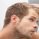 بهترین روش‌های درمان ریزش مو در مردان (مطلب)