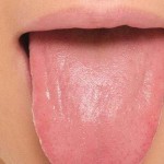 10 علت شایع گزگز نوک زبان (مطلب)