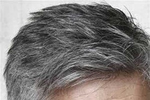عوامل متعدد در سفید شدن مو (مطلب)