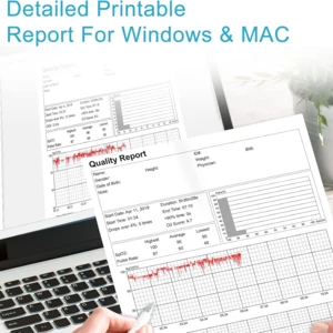 پالس اکسیمتر مچی هوشمند