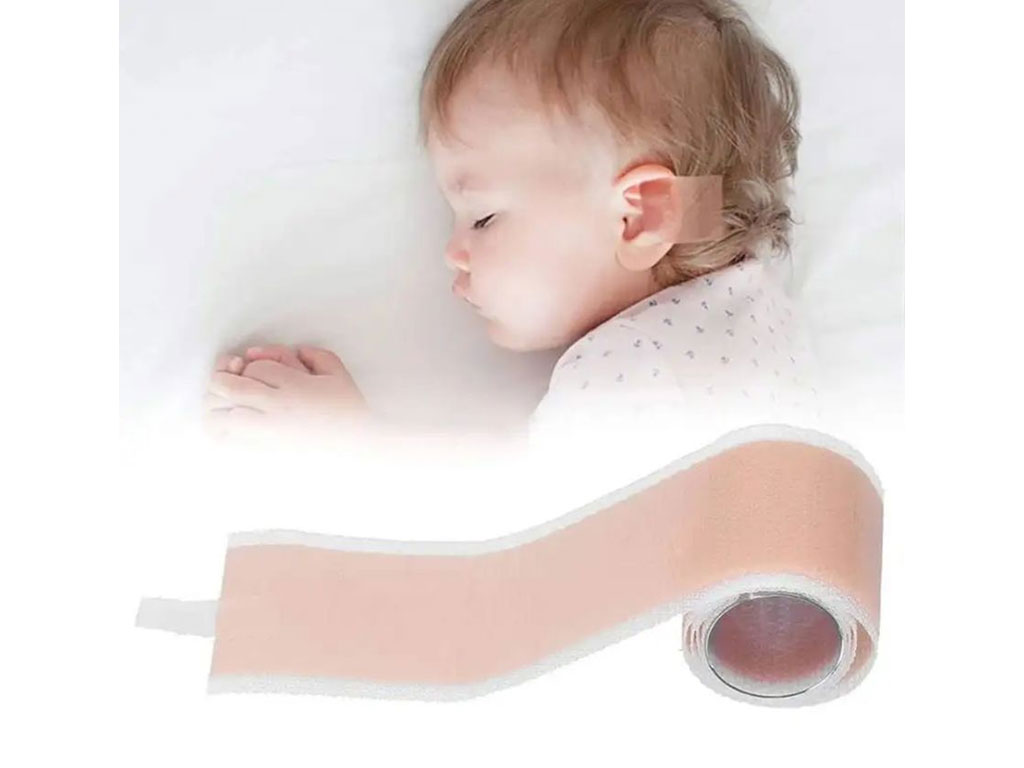 چسب اصلاح فرم گوش نوزاد مدل رولی سیتو بیبی