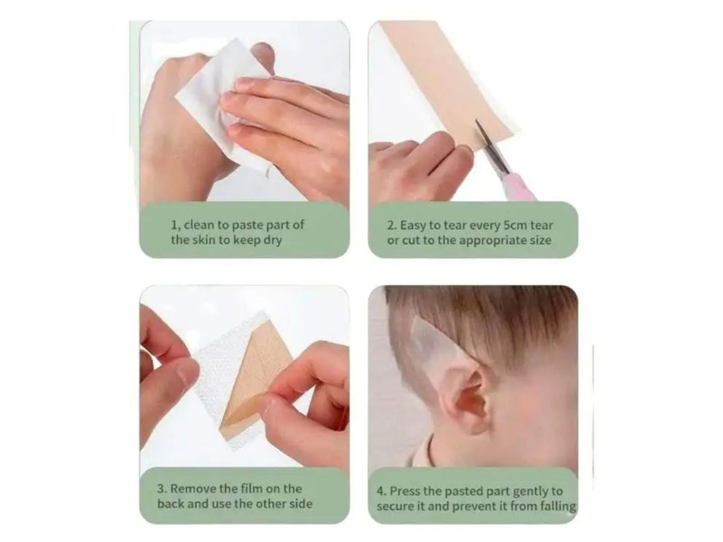 چسب اصلاح فرم گوش نوزاد مدل رولی سیتو بیبی