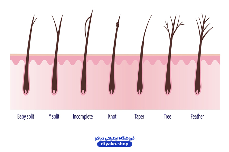 treatment split ends