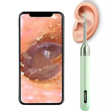 گوش پاک کن هوشمند زدیر شیائومی ZD-RS1-ED