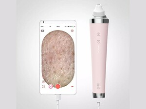 سرعت دستگاه پاک کننده جوش سرسیاه شیائومی Xiaomi Youpin Meishi Visible Nose Blackhead Remover GOODtime