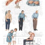 درمان بیماری پارکیسون parkinson disease با دستگاه فیزیوتراپی خانگی فارادیک بریجیس