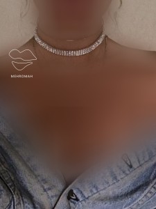 چوکر گردنی نگین دار کد 1049