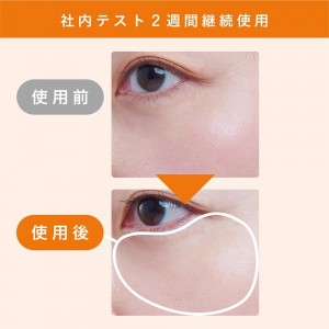 کرم درمانی سفیدکننده دورچشم Face Face