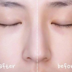 سرم ضد آفتاب Vitano C Serum روشن‌کننده ویتامین SPF50+ C