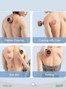 ست بادکش هوشمند  Cupping Therapy smart