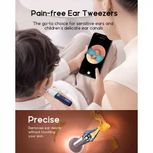 اتوسکوپ و گوش پاکن بی برد Bebird EAR-CARE sight plus I35R