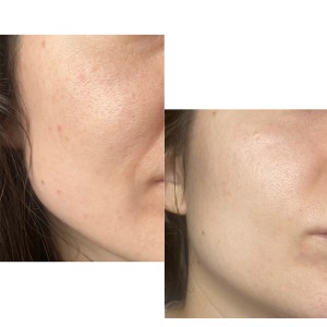 اسنس حلزون کوزارکس cosrx (اورجینال کره جنوبی)