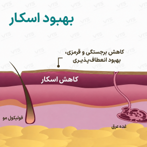 تأثیر سیلیکون بر کاهش برجستگی و قرمزی اسکار