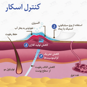 نحوه عملکرد ماتیک پروسیل و نوار سیلیکونی در کنترل و بهبود اسکار
