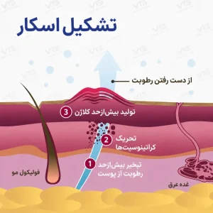 نمودار آموزشی تشکیل اسکار و تولید کلاژن