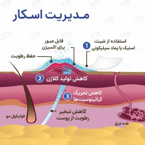 نحوه عملکرد نوار سیلیکونی بایودرمیس در حفظ رطوبت اسکار
