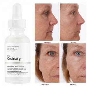 سرم هیالورونیک اسید 2% + B5 از برند اوردینری - The Ordinary Hyaluronic Acid 2% + B5