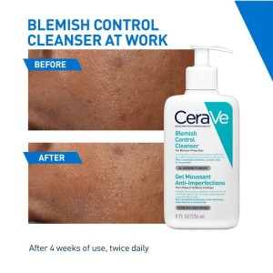 ژل شستشوی صورت سراوی CeraVe Blemish Control Cleanser