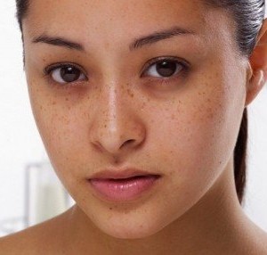 کرم ضد لک پیشرفته دپی‌وایت ای سی ام - ACM Advanced Intensive Anti-Dark Spot Cream