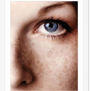 کرم ضد لک پیشرفته دپی‌وایت ای سی ام - ACM Advanced Intensive Anti-Dark Spot Cream