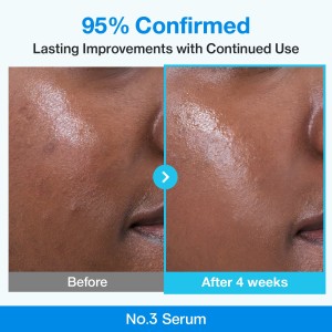 سرم تصفیه کننده منافذ با بیو-رتینول آبی شماره ۳ نامبوزین - Numbuzin No.3 Blue Bio-Retinol Pore Refining Serum