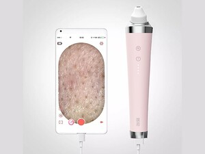 سرعت دستگاه پاک کننده جوش سرسیاه شیائومی Xiaomi Youpin Meishi Visible Nose Blackhead Remover GOODtime