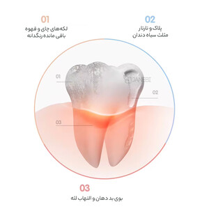 بهترین مسواک برقی شیائومی