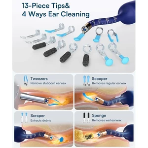 گوش پاک کن هوشمند شیائومی مدل Bebird I35R