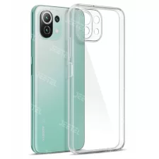 قاب گوشی Xiaomi MI 11 Lite مدل ژله ای طلقی محافظ لنزدار