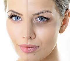 علل اصلی کبودی و سیاهی دور چشم و روش های درمان خانگی