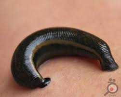 زالو و زالو درمانی