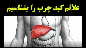 علائم کبد چرب و درمان انواع آن
