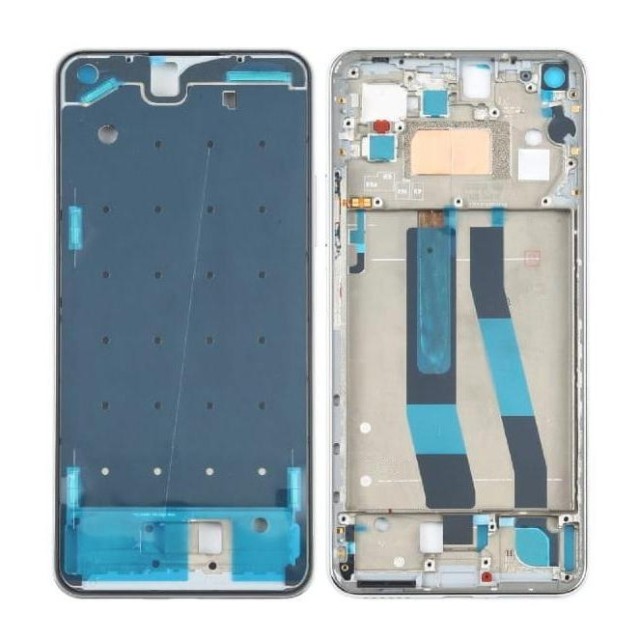 فریم و شاسی شیائومی Xiaomi Mi 11