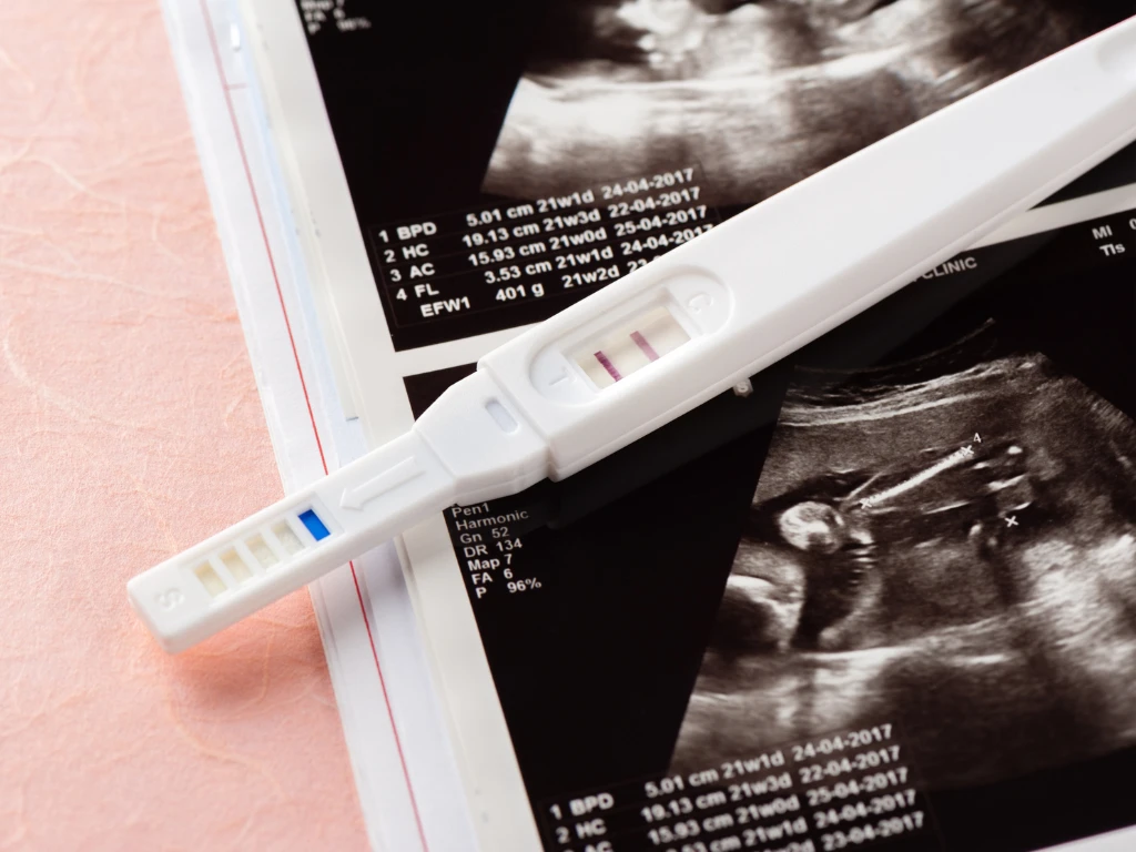 تغییرات مادر و جنین در ماه دوم بارداری؛ توصیه‌ها، نکات و هفته به هفته رشد جنین