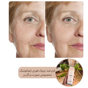 کرم ضد چروک فوری صورت و گردن ژنوبایوتیک 30ml