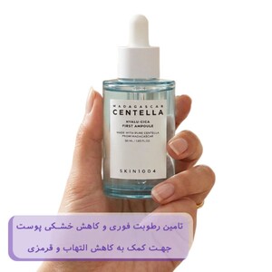 آمپول آبرسان سنتلا هیالو سیکا