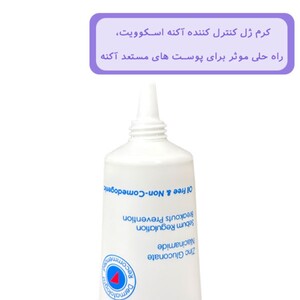 کرم ژل کنترل کننده آکنه اسکوویت Anti Acne