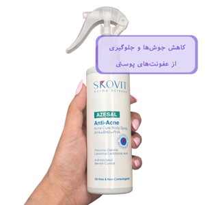 اسپری ضد جوش بدن اسکوویت Anti Acne