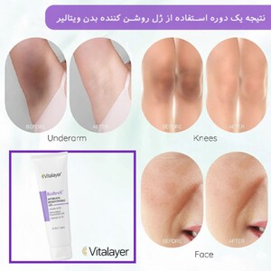 ژل روشن کننده نواحی حساس ویتالیر Bodyvit